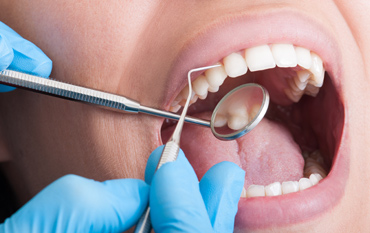 Mercury Free Filling