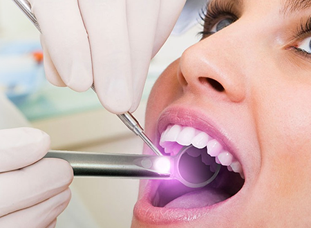 Oral Cancer Screening
