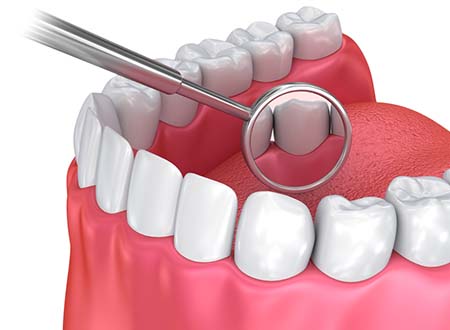 Oral Exams and Dental Cleanings