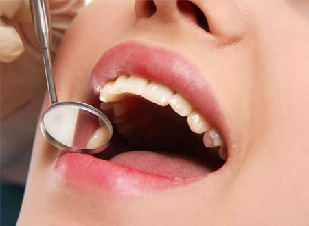 Dental Exams and Cleaning Treatment