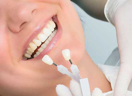 Porcelain Veneers Treatment