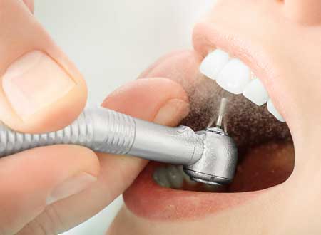 Restoring Dentistry Treatment